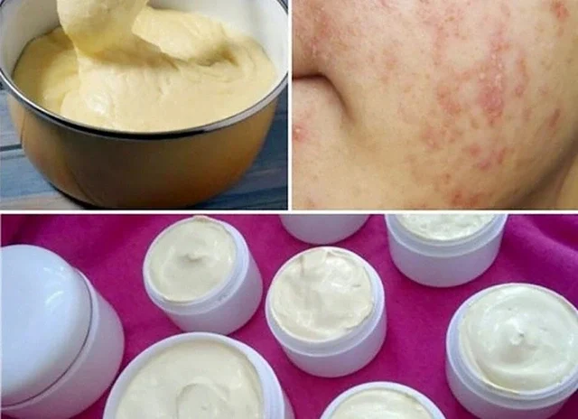 Hậu Quả Khôn Lường Khi Sử Dụng Mỹ Phẩm Giả, Kém Chất Lượng